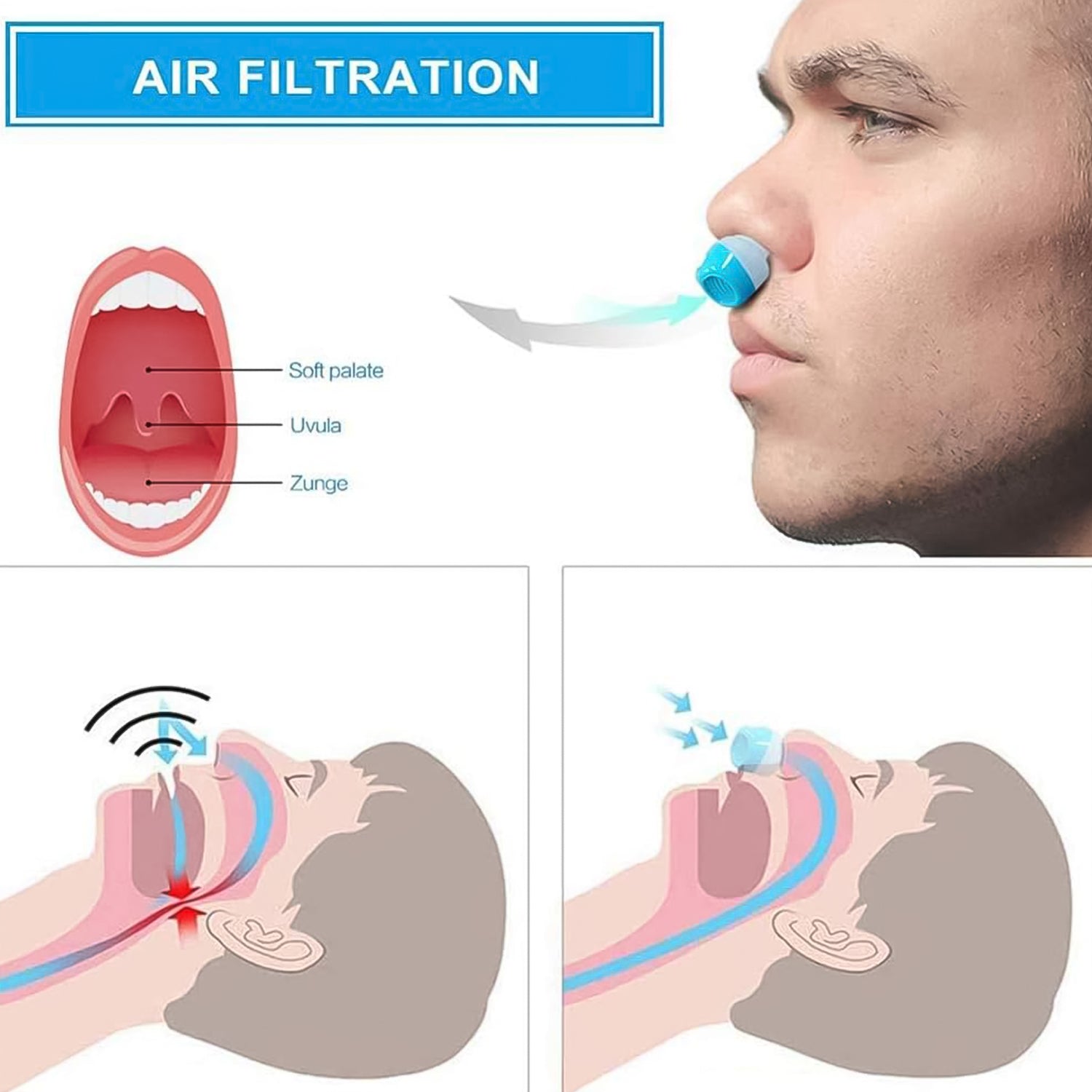Portable Anti-Snoring Nose Clip, shown ready for use to improve breathing.
